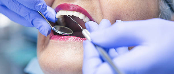 Best Emergency Root Canal Treatment in Dexter, OR